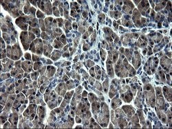 SMAD1 Monoclonal Antibody (OTI1C5), TrueMAB , OriGene 100 &mu;L; Unconjugated:Antibodies,