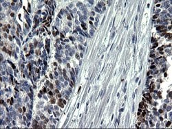SMAD1 Monoclonal Antibody (OTI1C5), TrueMAB , OriGene 100 &mu;L; Unconjugated:Antibodies,
