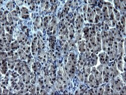 SMAD1 Monoclonal Antibody (OTI1E2), TrueMAB , OriGene:Antibodies:Primary