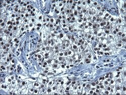 SMAD1 Monoclonal Antibody (OTI1E2), TrueMAB , OriGene 100 &mu;L; Unconjugated:Antibodies,