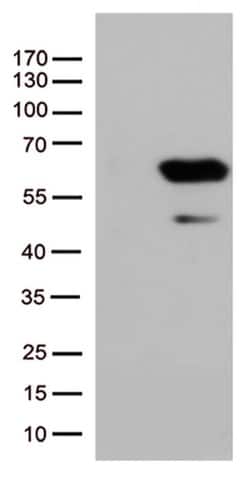 SMAD1 Monoclonal Antibody (OTI2D2), TrueMAB , OriGene:Antibodies:Primary