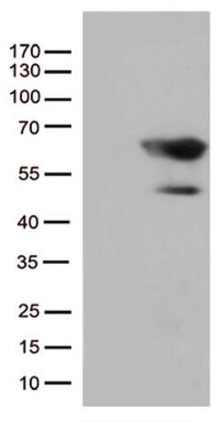 SMAD1 Mouse anti-Human, Clone: OTI1C2, lyophilized, TrueMAB 100 &mu;g;