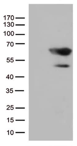 SMAD1 Monoclonal Antibody (OTI1C2), TrueMAB , OriGene:Antibodies:Primary