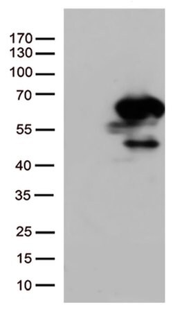 SMAD1 Monoclonal Antibody (OTI1C5), TrueMAB , OriGene 100 &mu;L; Unconjugated:Antibodies,