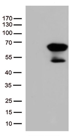 SMAD1 Monoclonal Antibody (OTI1E2), TrueMAB , OriGene 100 &mu;L; Unconjugated:Antibodies,