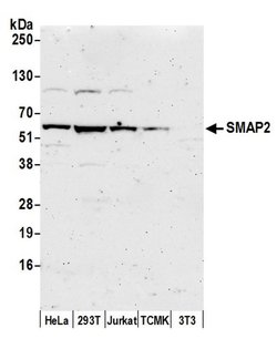 SMAP2 Polyclonal Antibody, Bethyl Laboratories 20 &mu;L; Unconjugated:Antibodies,