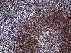 SMAP2 Mouse anti-Human, Clone: OTI6E11, lyophilized, TrueMAB 100 &mu;g;