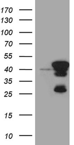 SMAP2 Mouse anti-Human, Clone: OTI6E11, lyophilized, TrueMAB 100 &mu;g;
