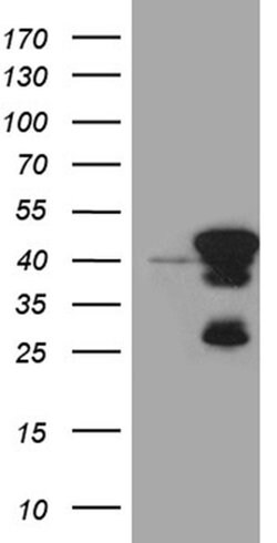 SMAP2 Monoclonal Antibody (OTI6E11), TrueMAB , OriGene 100 &mu;L; Unconjugated:Antibodies,