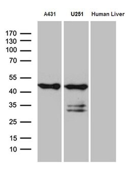 SMAP2 Monoclonal Antibody (OTI9B6), TrueMAB , OriGene 100 &mu;L; Unconjugated:Antibodies,