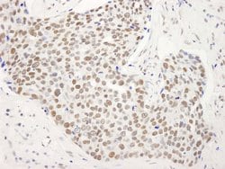 SMAR1/BANP Polyclonal Antibody, Bethyl Laboratories 100 &mu;L; Unconjugated:Antibodies,