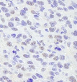 SMAR1/BANP Polyclonal Antibody, Bethyl Laboratories 100 &mu;L; Unconjugated:Antibodies,
