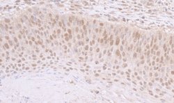 SMARCB1/SNF5 Rabbit anti-Human, Mouse, Polyclonal, Bethyl Laboratories