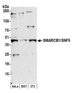 SMARCB1/SNF5 Rabbit anti-Human, Mouse, Polyclonal, Bethyl Laboratories