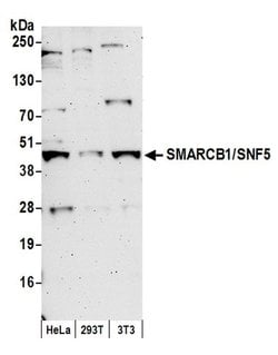 SMARCB1/SNF5 Polyclonal Antibody, Bethyl Laboratories 20 μL; Unconjugated:Antibodies,