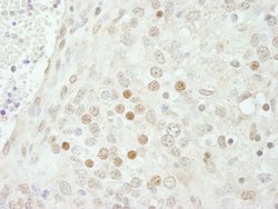 SMARCB1/SNF5 Polyclonal Antibody, Bethyl Laboratories 10 &mu;l; Unlabeled:Antibodies,