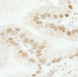 SMARCB1/SNF5 Polyclonal Antibody, Bethyl Laboratories:Antibodies:Primary