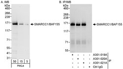 SMARCC1/BAF155 Rabbit anti-Human, Polyclonal, Bethyl Laboratories 100 &mu;L;