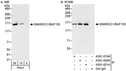 SMARCC1/BAF155 Rabbit anti-Human, Polyclonal, Bethyl Laboratories 100 &mu;L;