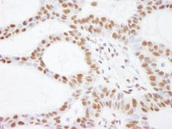 SMARCC2/BAF170 Rabbit anti-Human, Mouse, Polyclonal, Bethyl Laboratories
