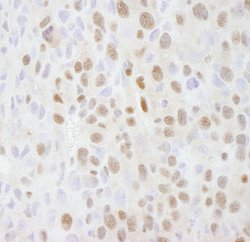 SMARCC2/BAF170 Polyclonal Antibody, Bethyl Laboratories:Antibodies:Primary