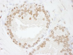 SMARCC2/BAF170 Polyclonal Antibody, Bethyl Laboratories 10 &mu;L; Unconjugated:Antibodies,