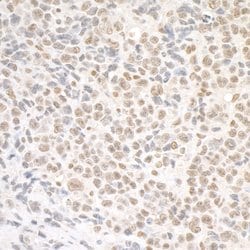 SMC1 Rabbit anti-Human, Mouse, Polyclonal, Bethyl Laboratories 100 &mu;L;