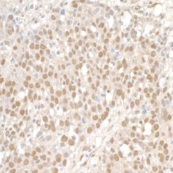 SMC1 Rabbit anti-Human, Mouse, Polyclonal, Bethyl Laboratories 100 &mu;L;