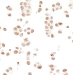 SMC1 Recombinant Rabbit Monoclonal Antibody (BL-205-2G8), Bethyl Laboratories:Antibodies:Primary