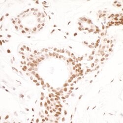 SMC1 Recombinant Rabbit Monoclonal Antibody (BL-205-2G8), Bethyl Laboratories