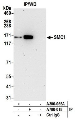 SMC1 Recombinant Rabbit Monoclonal Antibody (BL-205-2G8), Bethyl Laboratories