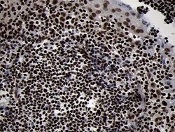 SMC1A Mouse anti-Human, Mouse, Clone: OTI11E1, lyophilized, TrueMAB 100 &mu;g | Buy Online | Origene Technologies | Fisher Scientific