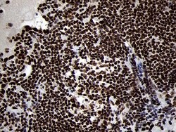 SMC1A Monoclonal Antibody (OTI3G4), TrueMAB , OriGene 100 &mu;L; Unconjugated:Antibodies,