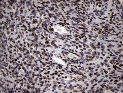 SMC1A Monoclonal Antibody (OTI3G4), TrueMAB , OriGene 100 &mu;L; Unconjugated:Antibodies,