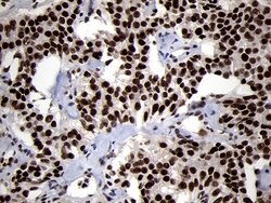 SMC1A Monoclonal Antibody (OTI3G4), TrueMAB , OriGene 100 &mu;L; Unconjugated:Antibodies,