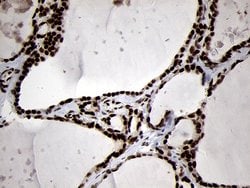 SMC1A Monoclonal Antibody (OTI3G4), TrueMAB , OriGene 100 &mu;L; Unconjugated:Antibodies,