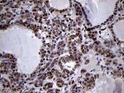 SMC1A Monoclonal Antibody (OTI3G4), TrueMAB , OriGene 100 &mu;L; Unconjugated:Antibodies,