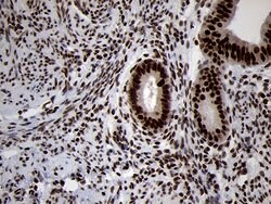 SMC1A Monoclonal Antibody (OTI3G4), TrueMAB , OriGene 100 &mu;L; Unconjugated:Antibodies,
