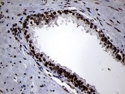 SMC1A Monoclonal Antibody (OTI3G4), TrueMAB , OriGene 100 &mu;L; Unconjugated:Antibodies,