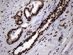 SMC1A Monoclonal Antibody (OTI3G4), TrueMAB , OriGene 100 &mu;L; Unconjugated:Antibodies,