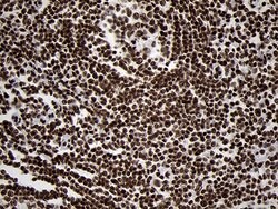 SMC1A Monoclonal Antibody (OTI3G4), TrueMAB , OriGene 100 &mu;L; Unconjugated:Antibodies,