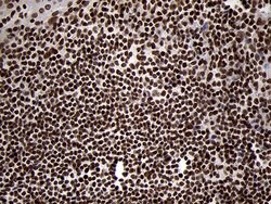 SMC1A Monoclonal Antibody (OTI3G4), TrueMAB , OriGene 100 &mu;L; Unconjugated:Antibodies,