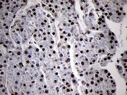 SMC1A Monoclonal Antibody (OTI3G4), TrueMAB , OriGene 100 &mu;L; Unconjugated:Antibodies,