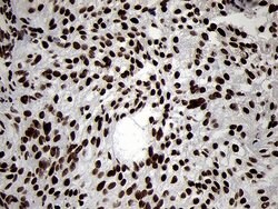 SMC1A Monoclonal Antibody (OTI3G4), TrueMAB , OriGene 100 &mu;L; Unconjugated:Antibodies,
