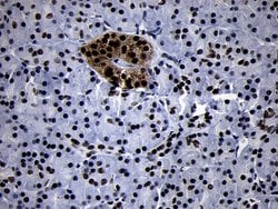 SMC1A Monoclonal Antibody (OTI5A1), TrueMAB , OriGene:Antibodies:Primary