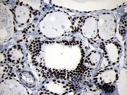 SMC1A Monoclonal Antibody (OTI5A1), TrueMAB , OriGene 100 &mu;L; Unconjugated:Antibodies,