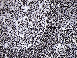 SMC1A Monoclonal Antibody (OTI5A1), TrueMAB , OriGene 100 &mu;L; Unconjugated:Antibodies,