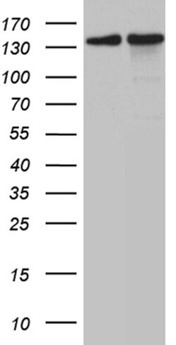 SMC1A Mouse anti-Human, Mouse, Clone: OTI11E1, lyophilized, TrueMAB 100 &mu;g | Buy Online | Origene Technologies | Fisher Scientific