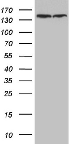 SMC1A Monoclonal Antibody (OTI3G4), TrueMAB , OriGene 100 &mu;L; Unconjugated:Antibodies,