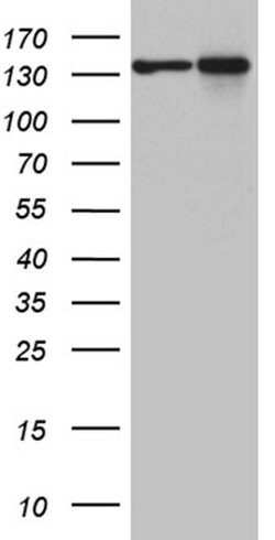 SMC1A Monoclonal Antibody (OTI5A1), TrueMAB , OriGene 100 &mu;L; Unconjugated:Antibodies,